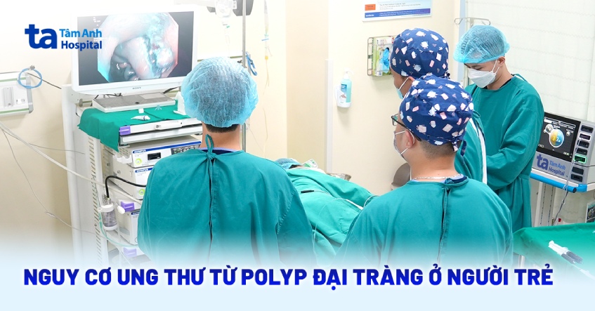 Nguy cơ ung thư từ polyp đại tràng ở người trẻ