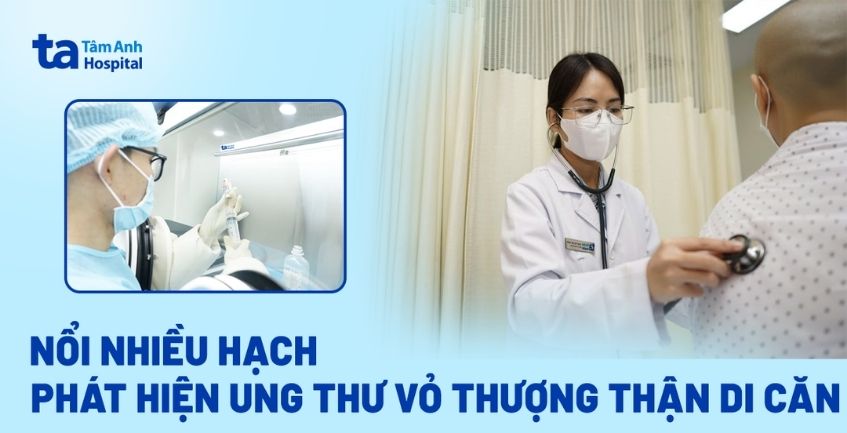 Nổi nhiều hạch hơn một năm, phát hiện ung thư vỏ thượng thận di căn