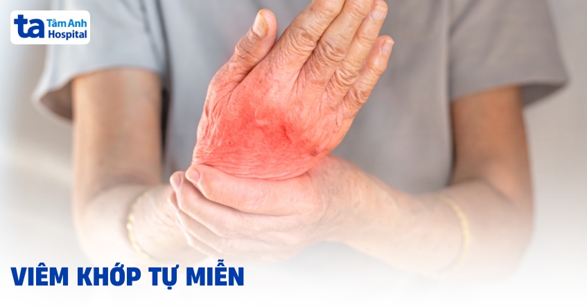 Viêm khớp tự miễn là gì? Dấu hiệu thường gặp và cách điều trị