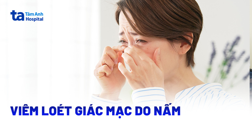 Viêm loét giác mạc do nấm điều trị ra sao? Nguyên nhân, triệu chứng