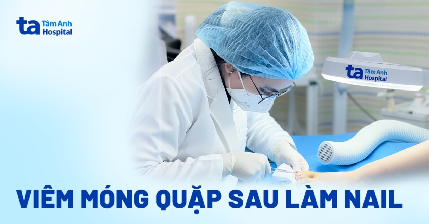 Viêm móng quặp sau làm nail