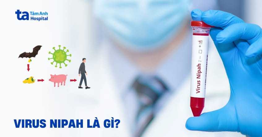 Virus Nipah là gì? Triệu chứng và cách phòng ngừa lây nhiễm