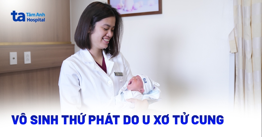 Vô sinh thứ phát do u xơ tử cung