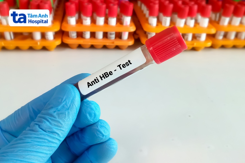 xét nghiệm anti hbe
