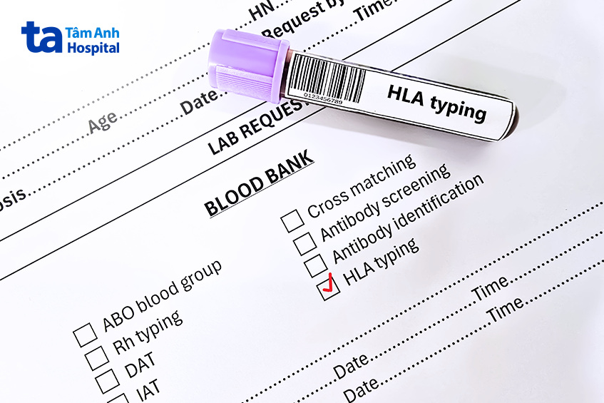 xét nghiệm kỹ trước khi ghép thận