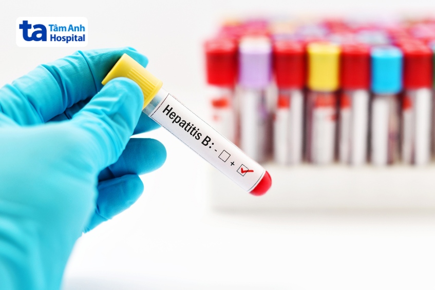 xét nghiệm viêm gan b tiến triển