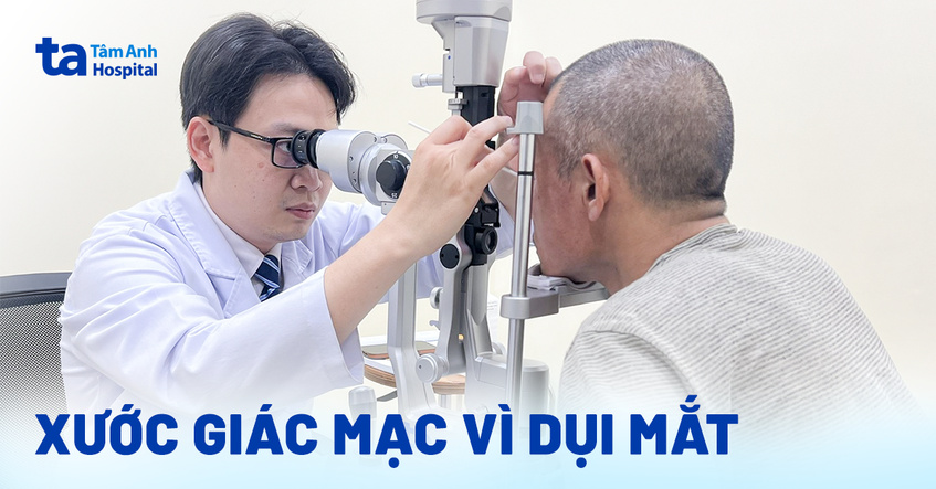 Xước giác mạc vì dụi mắt
