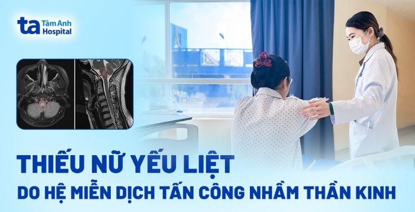 Thiếu nữ yếu liệt do hệ miễn dịch tấn công nhầm thần kinh