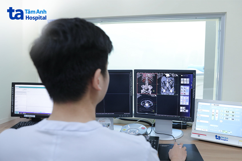 bác sĩ đang xem kết quả từ hệ thống CT Scan hơn 100.000 lát cắt