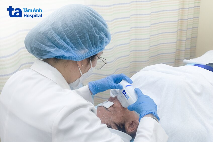 bác sĩ dùng hifu cải thiện da chảy xệ