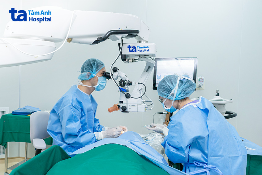 kính hiển vi chuyên dùng trong phẫu thuật phaco của Mỹ hỗ trợ bác sĩ quan sát vùng mổ với độ phóng đại cao