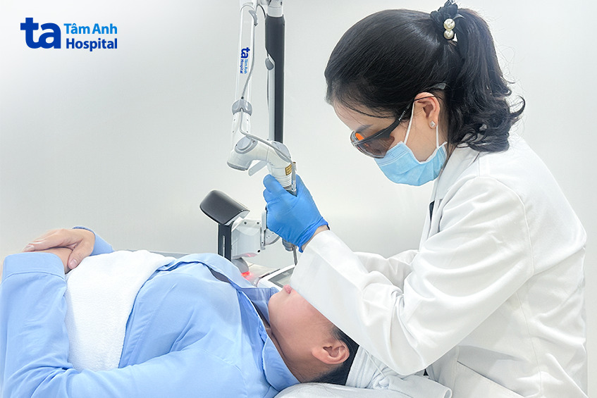 Bác sĩ sử dụng laser pico pro điều trị nám cho chị Hường