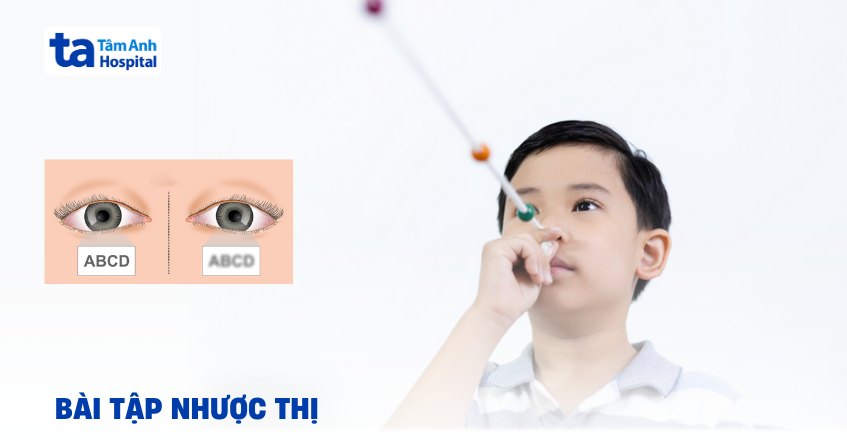 Các bài tập nhược thị dễ giúp cải thiện mắt ngay tại nhà