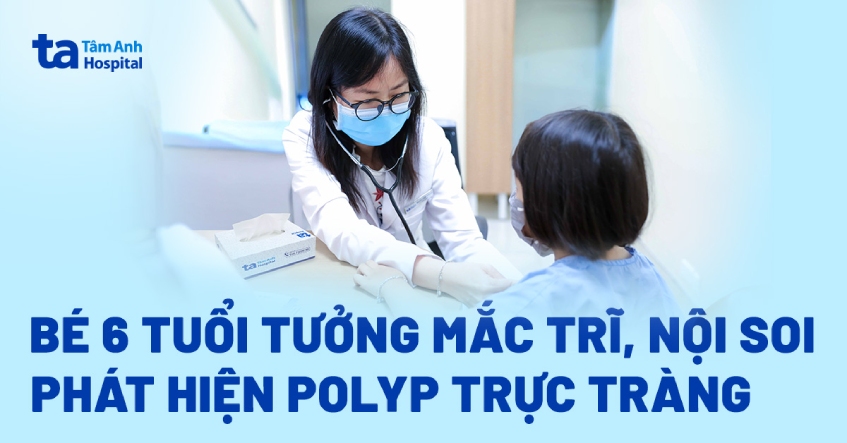 Bé 6 tuổi tưởng mắc trĩ, nội soi phát hiện polyp trực tràng