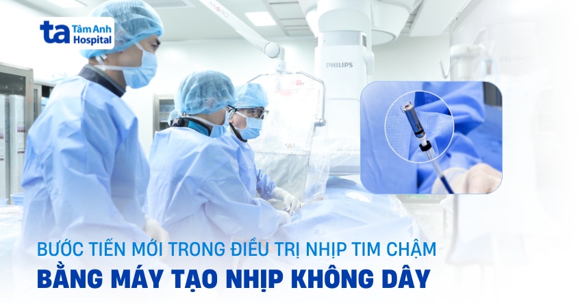 Bước tiến mới trong điều trị nhịp tim chậm bằng máy tạo nhịp không dây