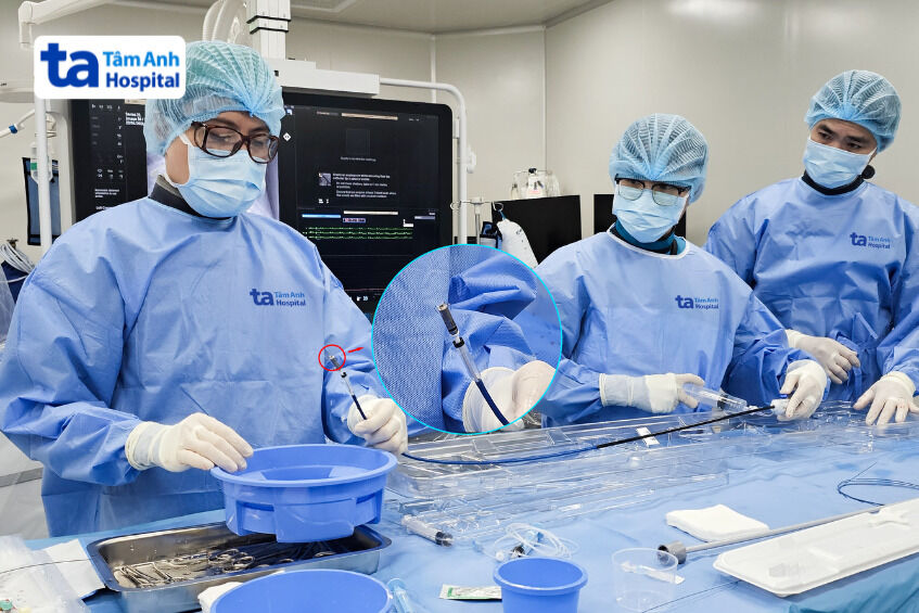 các bác sĩ đang chuẩn bị đưa Micra AV2 vào buồng tim người bệnh