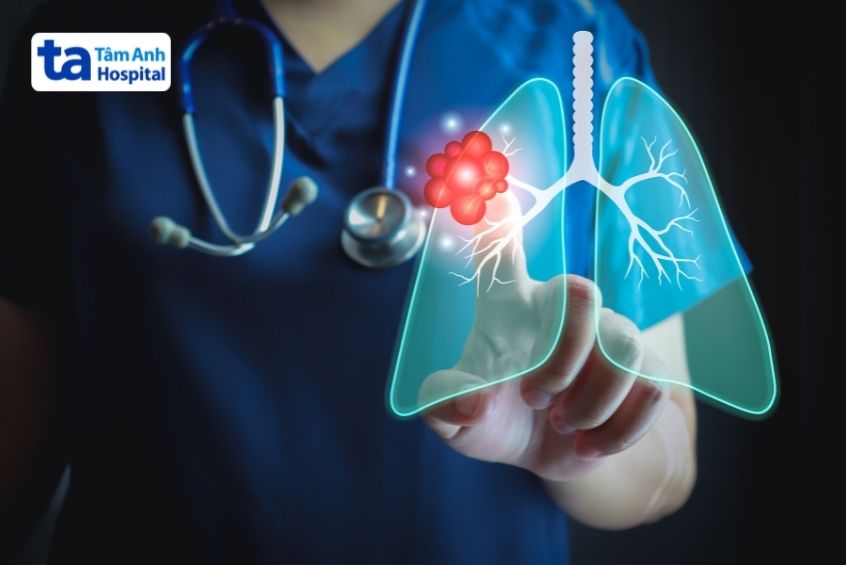 chất gây ung thư gây tăng sinh tế bào bất thường dẫn đến ung thư