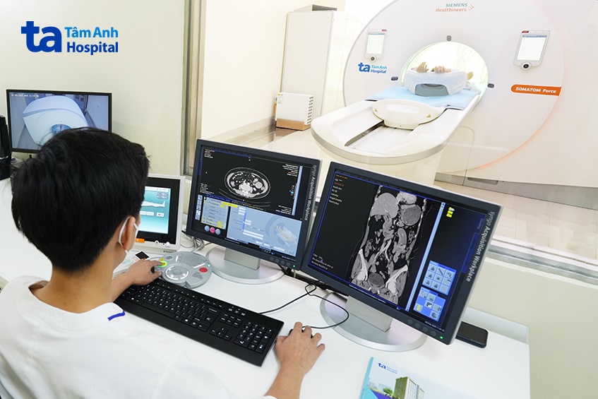 chụp khối u ruột non