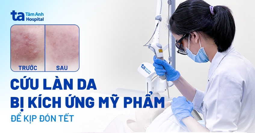 Cứu làn da bị kích ứng mỹ phẩm để kịp đón Tết
