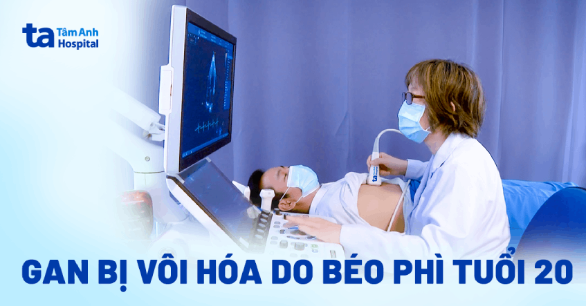 Gan bị vôi hóa do béo phì tuổi 20