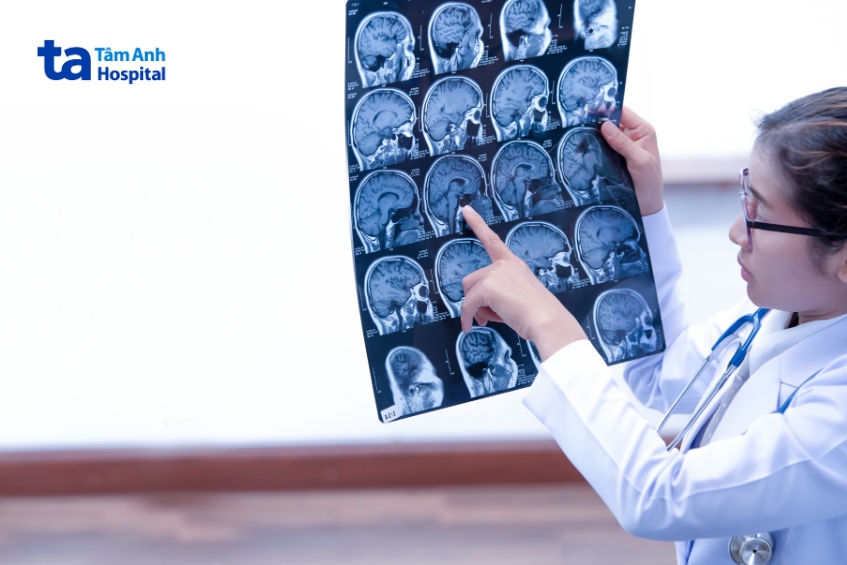 kết quả chẩn đoán hình ảnh là một trong những cơ sở quan trọng