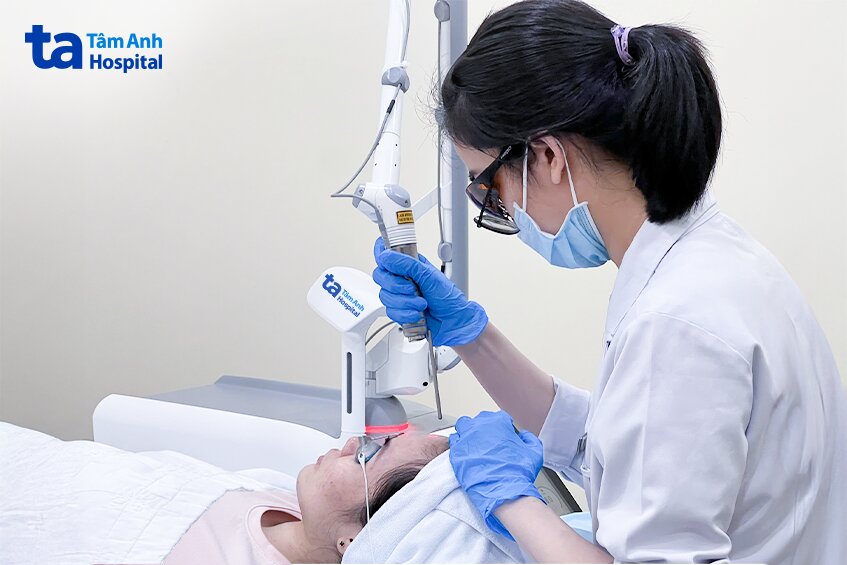 laser pico điều trị thâm sau mụn viêm