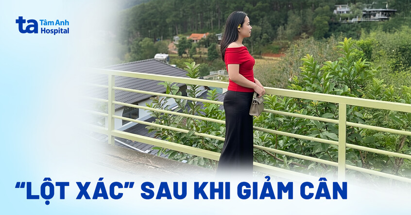 “Lột xác” sau khi giảm cân