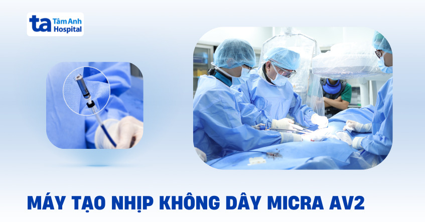 Máy tạo nhịp không dây MICRA AV2: Lợi ích và chỉ định cấy ghép