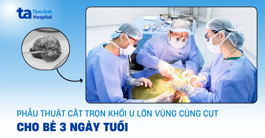 Mổ bóc u lớn vùng cùng cụt cho bé 3 ngày tuổi