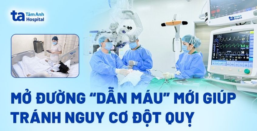 Mở đường ‘dẫn máu’ mới giúp tránh nguy cơ đột quỵ