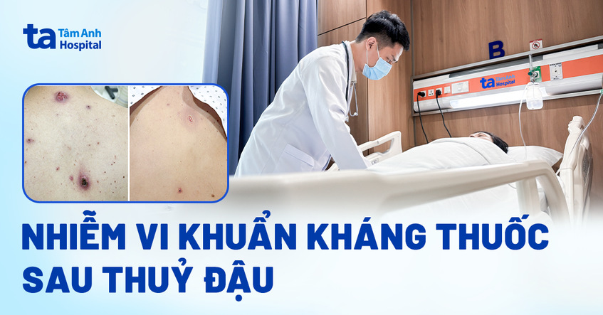 Nhiễm vi khuẩn kháng thuốc sau thuỷ đậu
