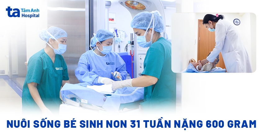 Nuôi sống bé sinh non 31 tuần nặng 600 gram