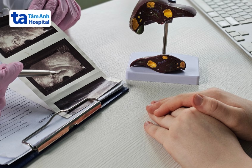 phân thùy bên gan