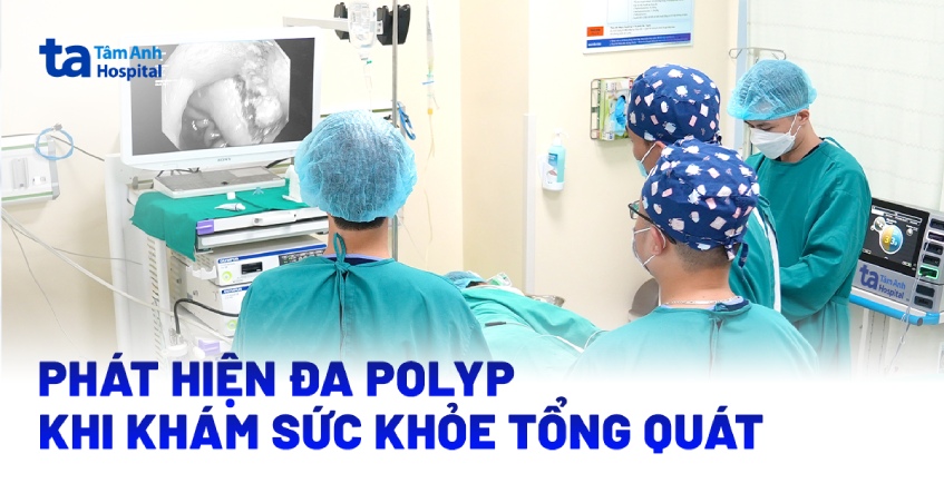 Người phụ nữ 36 tuổi phát hiện đa polyp khi khám sức khỏe tổng quát