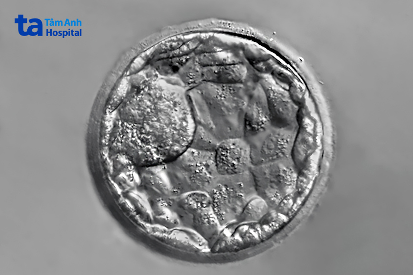 Phôi trữ đông có thể được sàng lọc di truyền tiền làm tổ