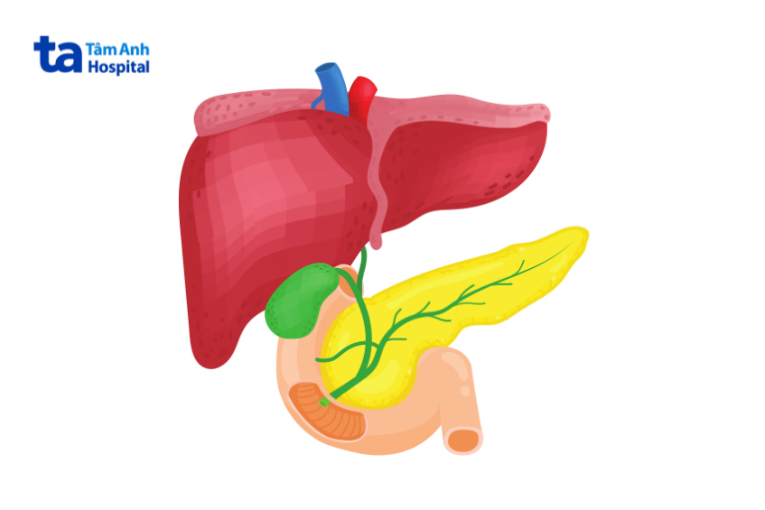 tắc đường mật ngoài gan