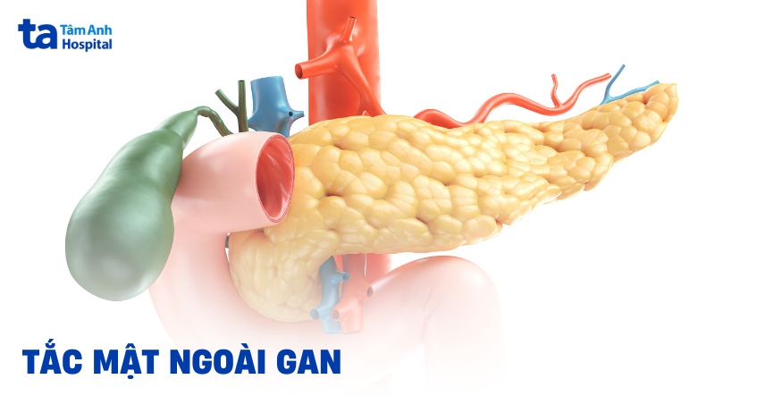 Tắc mật ngoài gan: Dấu hiệu nhận biết và phòng ngừa