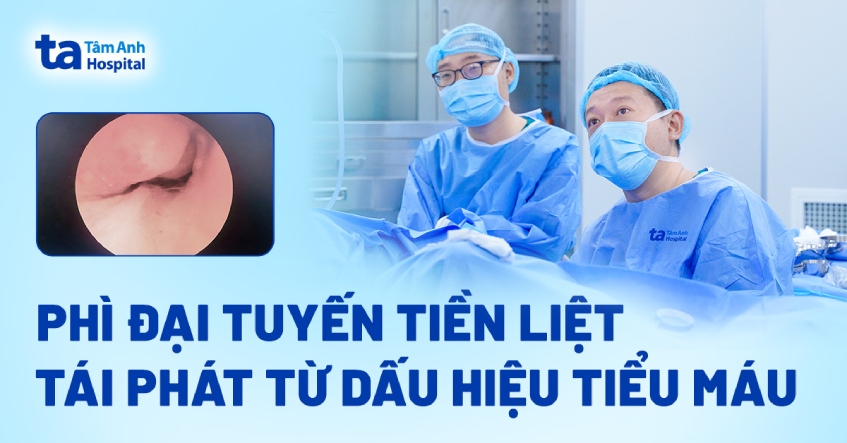 Đi tiểu ra máu do phì đại tuyến tiền liệt tái phát