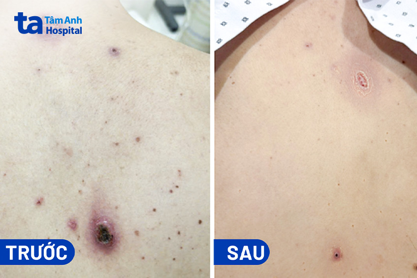 tình trạng của người bệnh trước và sau khi điều trị