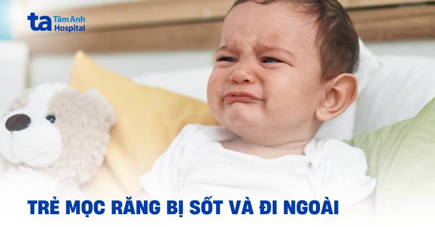 Vì sao trẻ mọc răng bị sốt và đi ngoài? Hướng dẫn chăm sóc