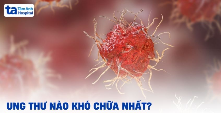 Bạn có biết loại ung thư nào khó chữa nhất?