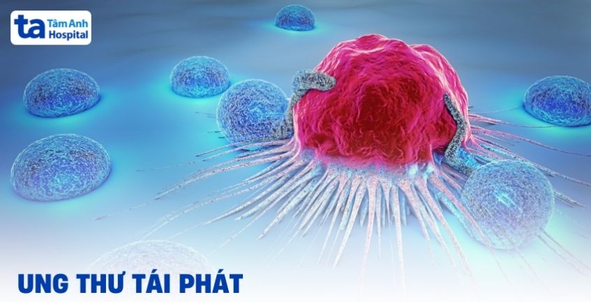 Hiểu đúng về ung thư tái phát và những điều cần chuẩn bị