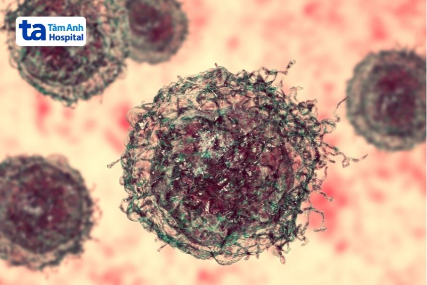 ung thư trung biểu mô là bệnh hiếm