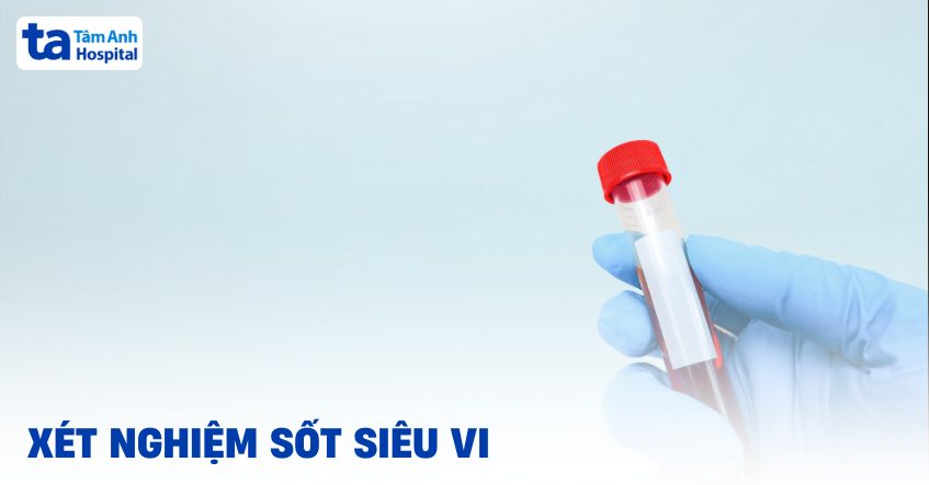 Xét nghiệm sốt siêu vi gồm những gì? Chi phí bao nhiêu?