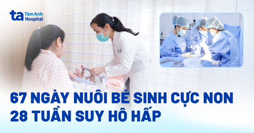 67 ngày nuôi bé sinh cực non 28 tuần suy hô hấp