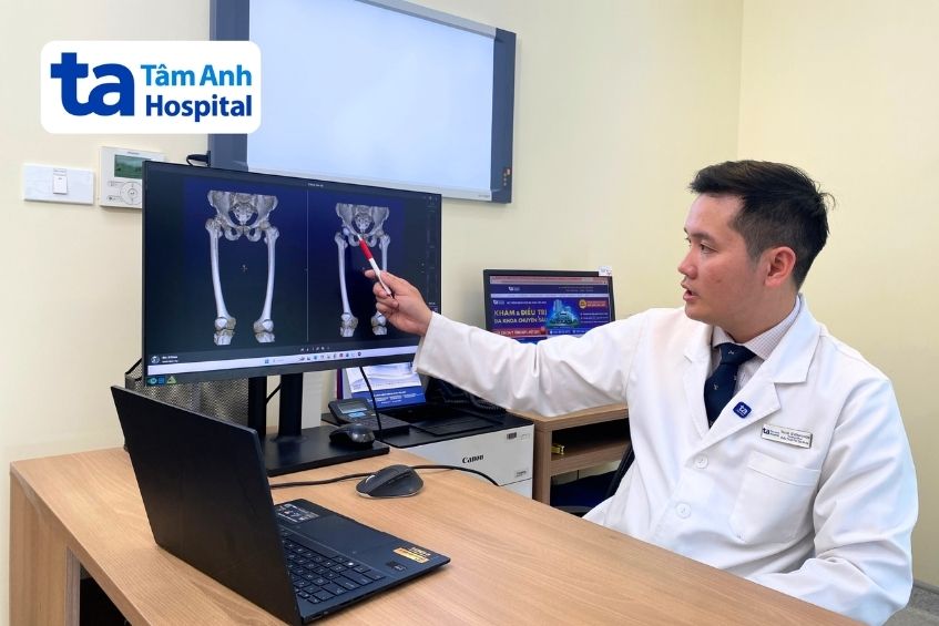 bác sĩ đánh giá tình trạng khớp hàng