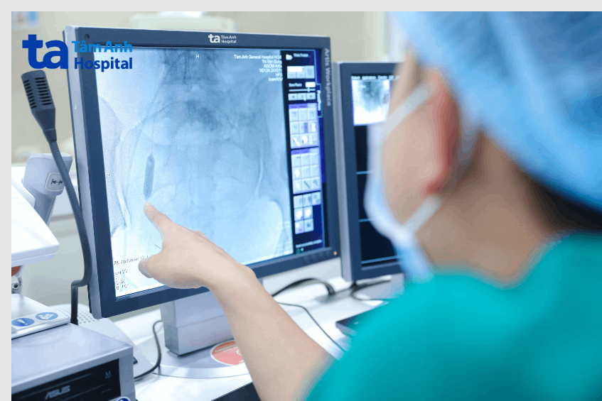 Các bác sĩ phân tích hình ảnh vị trí bóng chèn đặt tại động mạch chậu cho người bệnh.