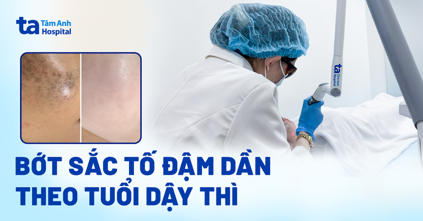 Bớt sắc tố đậm dần theo tuổi dậy thì