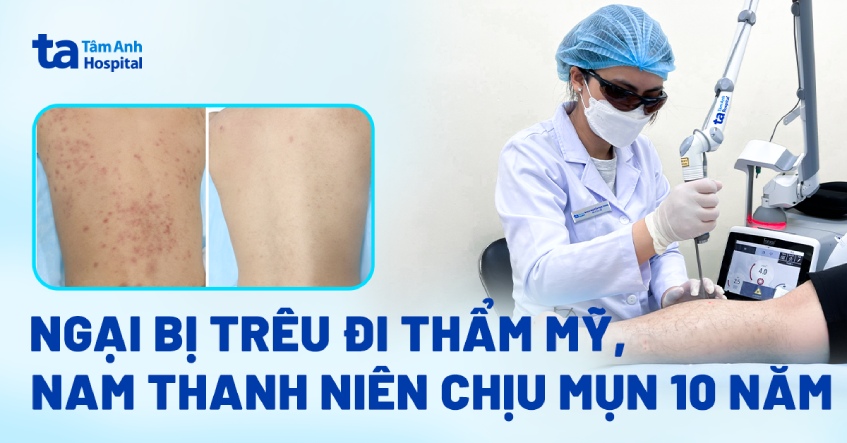 Ngại bị trêu đi thẩm mỹ, nam thanh niên chịu mụn 10 năm