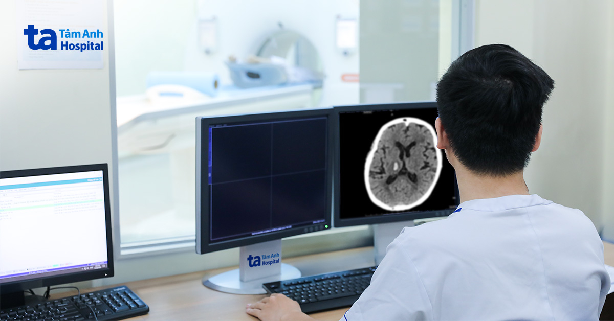 Đột quỵ vì không điều trị tăng huyết áp